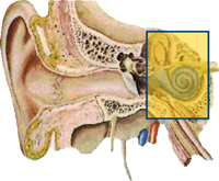 Sensorineaural Hearing Loss