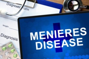 All You Need To Know About Meniere’s Disease