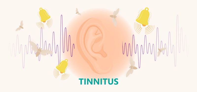Tinnitus